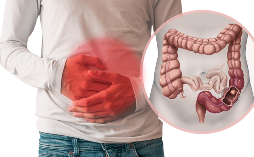Robotic Surgery for Safer Recovery | Dr. Zarak, FL